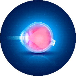 Lens gif